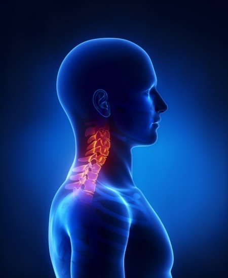 The Treatment of Neck Pain–Associated Disorders and Whiplash-Associated ...